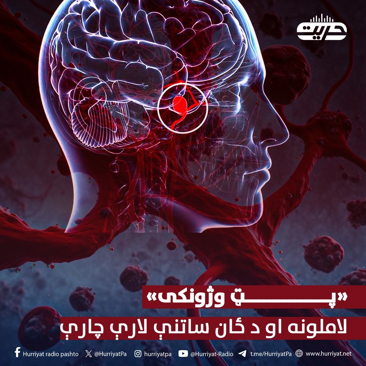 «پټ وژونکی»... لاملونه او د ځان ساتنې لارې چارې